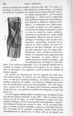 Fig. 107 - Traité de médecine opératoire, bandages et appareils. 4è éd. Tome second