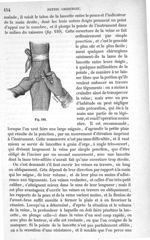 Fig. 110 - Traité de médecine opératoire, bandages et appareils. 4è éd. Tome second