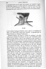 Fig. 120 - Traité de médecine opératoire, bandages et appareils. 4è éd. Tome second