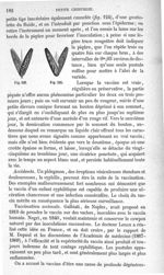 Fig. 123, 124 - Traité de médecine opératoire, bandages et appareils. 4è éd. Tome second
