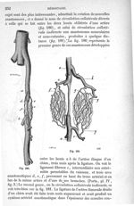 Fig. 180., Fig. 181 - Traité de médecine opératoire, bandages et appareils. 4è éd. Tome second