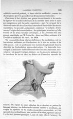 Fig. 186 - Traité de médecine opératoire, bandages et appareils. 4è éd. Tome second
