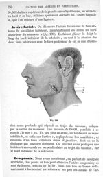 Fig. 188 - Traité de médecine opératoire, bandages et appareils. 4è éd. Tome second