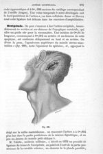 Fig. 189 - Traité de médecine opératoire, bandages et appareils. 4è éd. Tome second