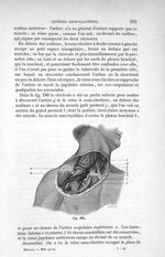 Fig. 190 - Traité de médecine opératoire, bandages et appareils. 4è éd. Tome second