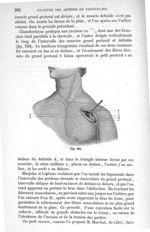 Fig. 194 - Traité de médecine opératoire, bandages et appareils. 4è éd. Tome second