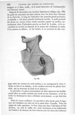 Fig. 195 - Traité de médecine opératoire, bandages et appareils. 4è éd. Tome second