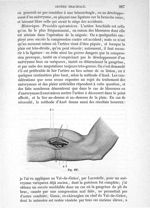 Fig. 197 - Traité de médecine opératoire, bandages et appareils. 4è éd. Tome second