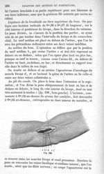 Fig. 198 - Traité de médecine opératoire, bandages et appareils. 4è éd. Tome second