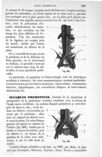 Fig. 205., Fig. 206 - Traité de médecine opératoire, bandages et appareils. 4è éd. Tome second