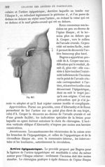 Fig. 207 - Traité de médecine opératoire, bandages et appareils. 4è éd. Tome second