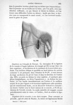 Fig. 209 - Traité de médecine opératoire, bandages et appareils. 4è éd. Tome second