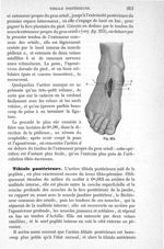 Fig. 215 - Traité de médecine opératoire, bandages et appareils. 4è éd. Tome second