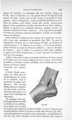 Fig. 217 - Traité de médecine opératoire, bandages et appareils. 4è éd. Tome second