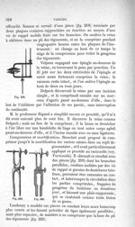 Fig. 218., 219., 220 - Traité de médecine opératoire, bandages et appareils. 4è éd. Tome second
