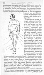 Fig. 226 - Traité de médecine opératoire, bandages et appareils. 4è éd. Tome second