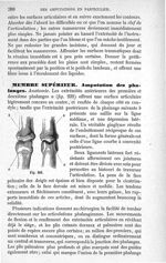 Fig. 231 - Traité de médecine opératoire, bandages et appareils. 4è éd. Tome second