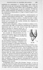 Fig. 245 - Traité de médecine opératoire, bandages et appareils. 4è éd. Tome second