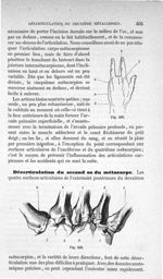 Fig. 248., Fig. 249 - Traité de médecine opératoire, bandages et appareils. 4è éd. Tome second