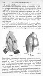 Fig. 261., Fig. 262 - Traité de médecine opératoire, bandages et appareils. 4è éd. Tome second