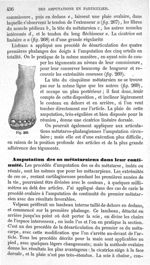 Fig. 269 - Traité de médecine opératoire, bandages et appareils. 4è éd. Tome second