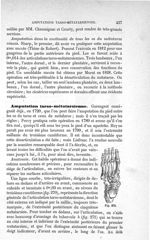 Fig. 270 - Traité de médecine opératoire, bandages et appareils. 4è éd. Tome second