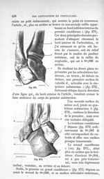Fig. 271., Fig. 272 - Traité de médecine opératoire, bandages et appareils. 4è éd. Tome second