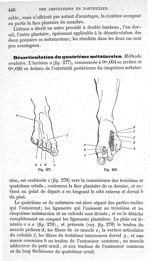 Fig. 277., Fig. 278 - Traité de médecine opératoire, bandages et appareils. 4è éd. Tome second