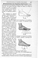Fig. 279. à Fig. 281 - Traité de médecine opératoire, bandages et appareils. 4è éd. Tome second