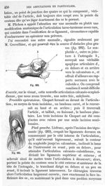 Fig. 282., Fig. 283 - Traité de médecine opératoire, bandages et appareils. 4è éd. Tome second