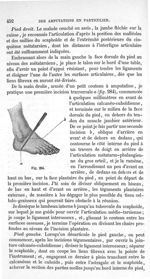 Fig. 284 - Traité de médecine opératoire, bandages et appareils. 4è éd. Tome second