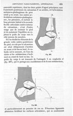 Fig. 287., Fig. 288 - Traité de médecine opératoire, bandages et appareils. 4è éd. Tome second