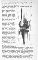 Fig. 303 - Traité de médecine opératoire, bandages et appareils. 4è éd. Tome second