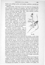 Fig. 305 - Traité de médecine opératoire, bandages et appareils. 4è éd. Tome second