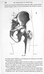 Fig. 307 - Traité de médecine opératoire, bandages et appareils. 4è éd. Tome second
