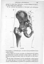 Fig. 308 - Traité de médecine opératoire, bandages et appareils. 4è éd. Tome second