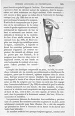 Fig. 319 - Traité de médecine opératoire, bandages et appareils. 4è éd. Tome second