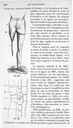 Fig. 320., Fig. 321 - Traité de médecine opératoire, bandages et appareils. 4è éd. Tome second