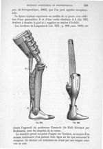 Fig. 325., Fig. 326 - Traité de médecine opératoire, bandages et appareils. 4è éd. Tome second