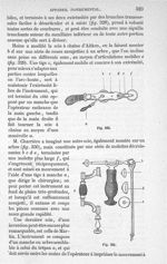 Fig. 330., Fig. 331 - Traité de médecine opératoire, bandages et appareils. 4è éd. Tome second