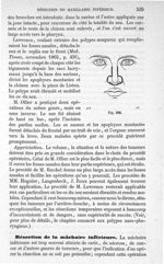 Fig. 338 - Traité de médecine opératoire, bandages et appareils. 4è éd. Tome second
