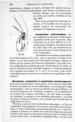 Fig. 343 - Traité de médecine opératoire, bandages et appareils. 4è éd. Tome second