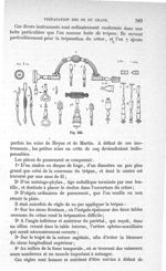 Fig. 350 - Traité de médecine opératoire, bandages et appareils. 4è éd. Tome second