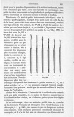 Fig. 355 - Traité de médecine opératoire, bandages et appareils. 4è éd. Tome second
