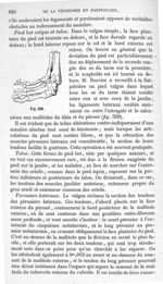Fig. 359 - Traité de médecine opératoire, bandages et appareils. 4è éd. Tome second