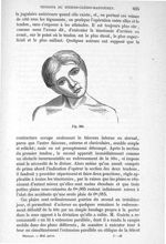 Fig. 360 - Traité de médecine opératoire, bandages et appareils. 4è éd. Tome second