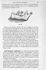 Fig. 361 - Traité de médecine opératoire, bandages et appareils. 4è éd. Tome premier