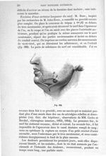 Fig. 362 - Traité de médecine opératoire, bandages et appareils. 4è éd. Tome premier