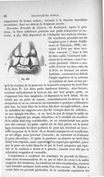 Fig. 364 - Traité de médecine opératoire, bandages et appareils. 4è éd. Tome premier