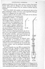 Fig. 375., Fig. 376 - Traité de médecine opératoire, bandages et appareils. 4è éd. Tome premier